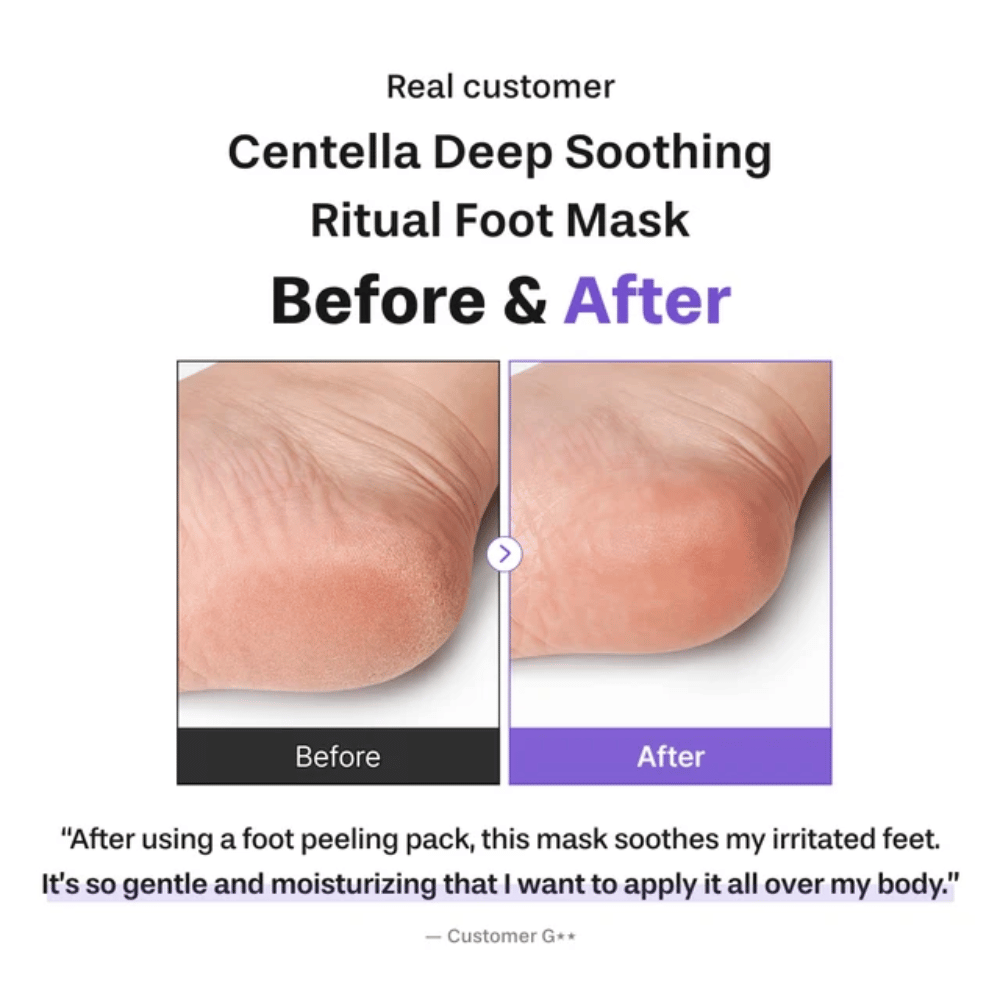 6. Baren Centella Deep Soothing Ritual Foot Mask – obrázok pred a po, ktorý ukazuje jemnejšiu a viac hydratovanú pätu po použití