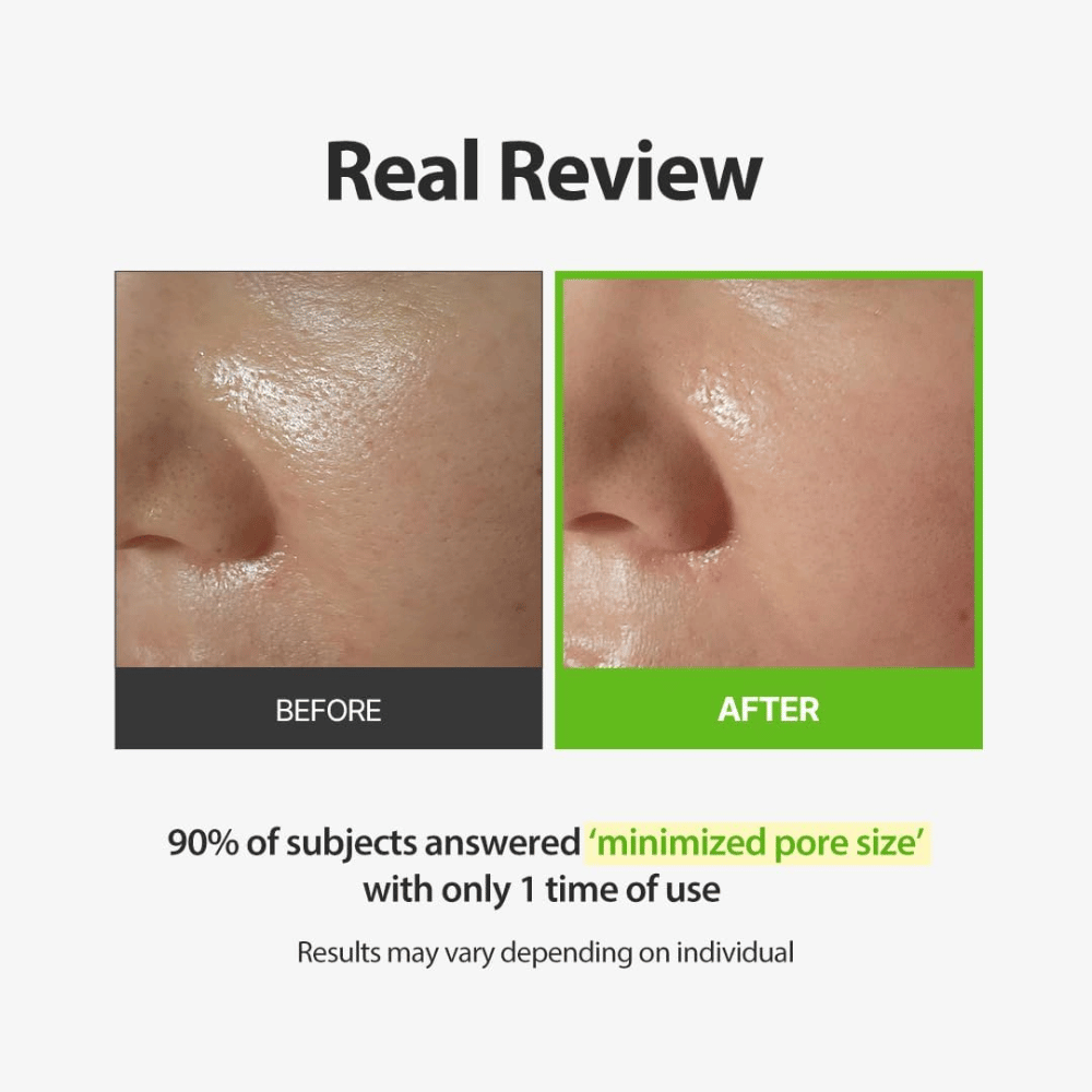 SUNGBOON EDITOR Green Tomato Pore Peeling Jumbo Pad – fotografia pred a po so zameraním na viditeľné póry