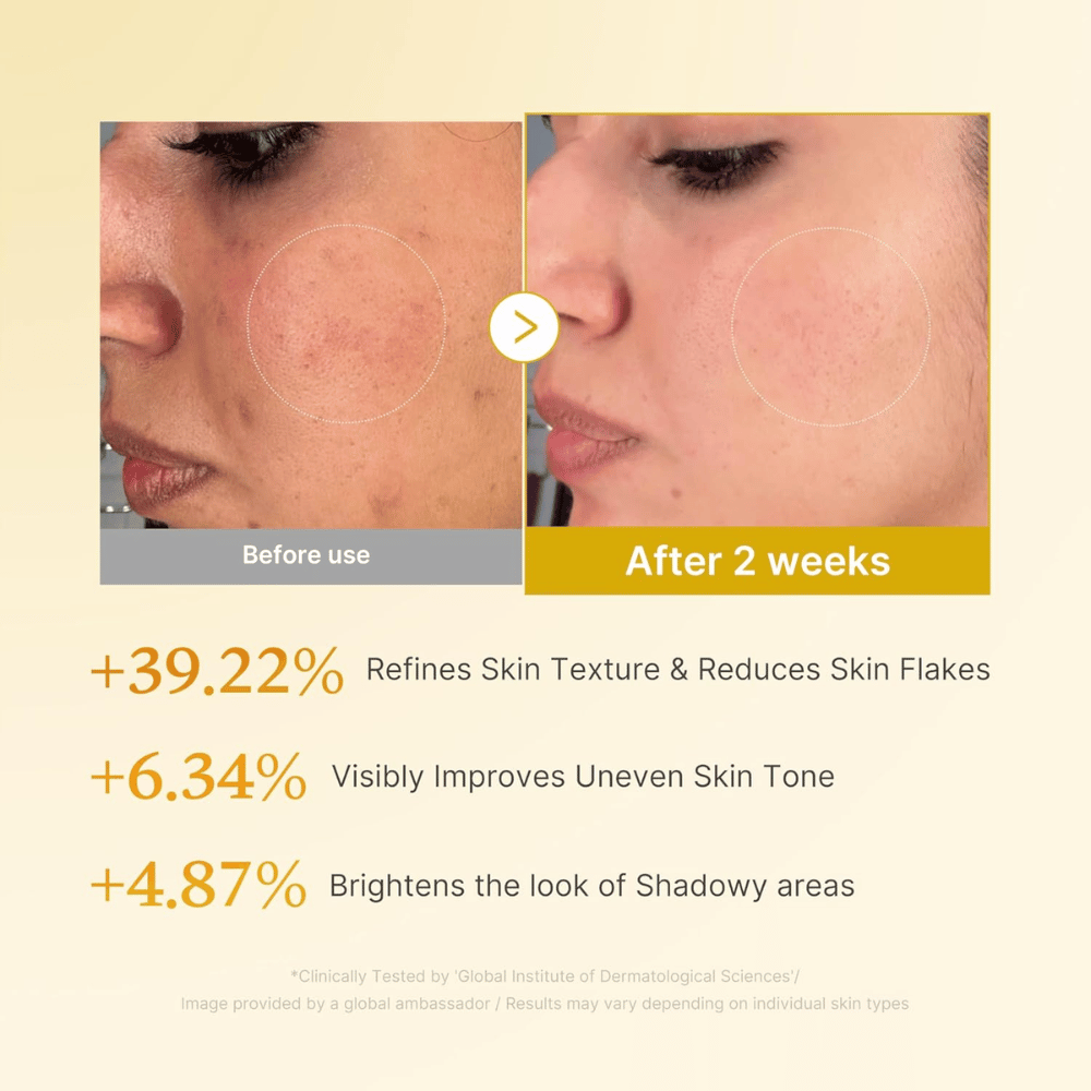 Obrázok pred a po pre Medicube Kojic Acid Turmeric Resurfacing Toner, ktorý ukazuje zlepšenú textúru pokožky, zjednotenejší tón pleti a zníženie suchých šupiniek po dvoch týždňoch používania.