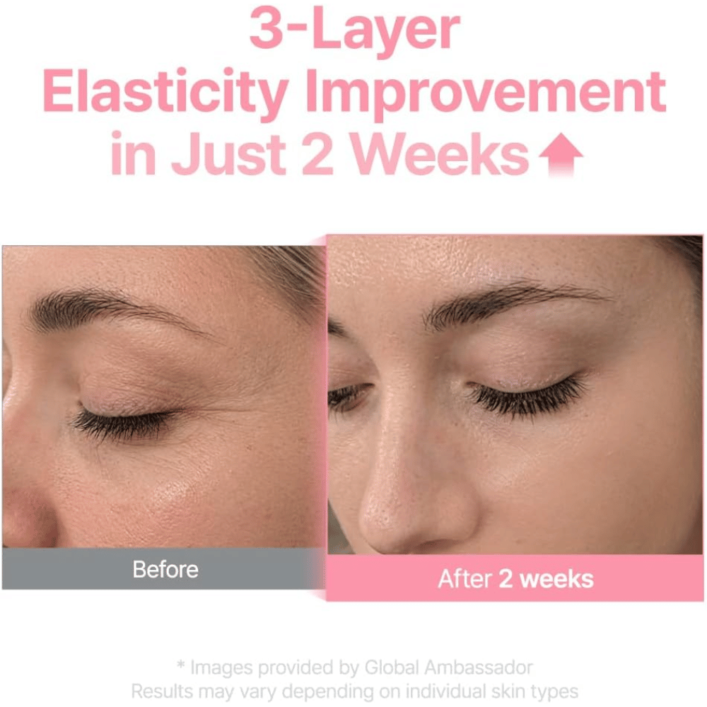 Obrázok pred a po pre Purito Multi PDRN Collagen EGF Serum, ktorý ukazuje zlepšenú elasticitu pleti po dvoch týždňoch.