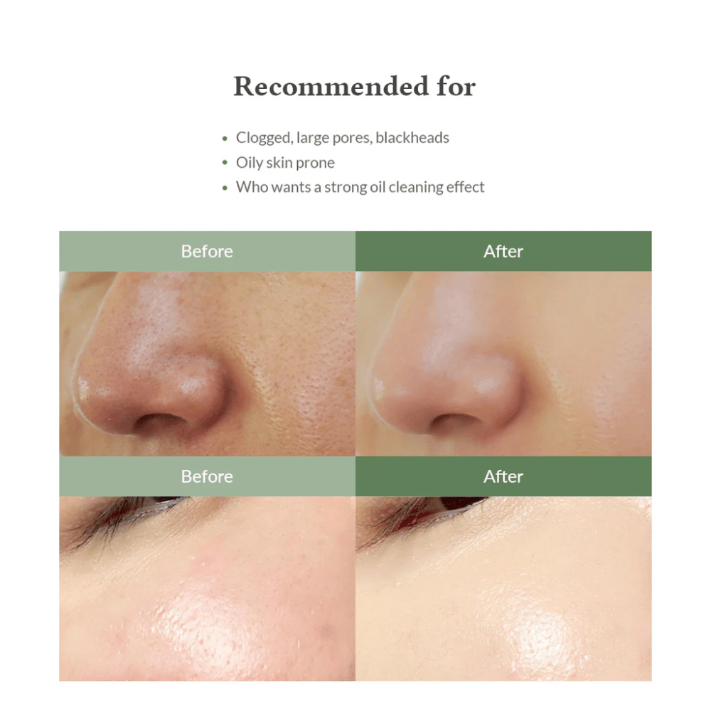 Dr. Althea Premium Quick Step Sebum Cleanser – čistenie tváre, ktoré pomáha znižovať čierne bodky, dôkladne čistiť póry a poskytovať rovnomernejšiu štruktúru pokožky.