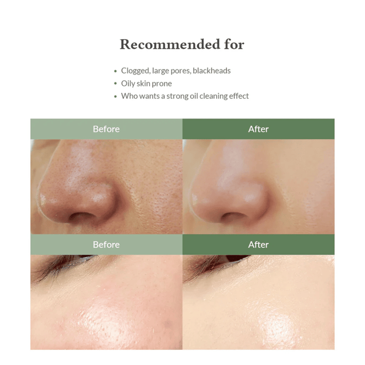 Dr. Althea Premium Quick Step Sebum Cleanser – čistenie tváre, ktoré pomáha znižovať čierne bodky, dôkladne čistiť póry a poskytovať rovnomernejšiu štruktúru pokožky.